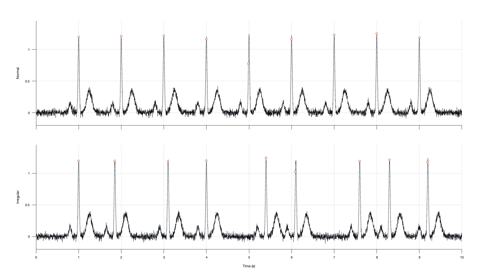 Normal and irregular simulated ECG traces with each detected R peak circled