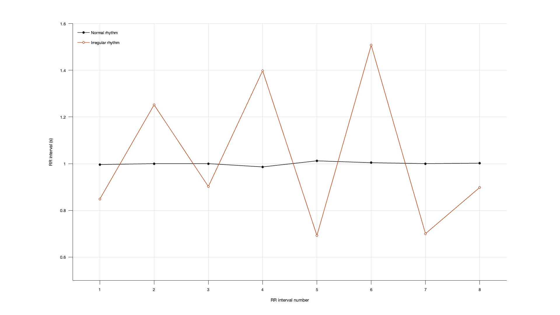 RR interval by beat number. The normal rhythm stays flat near 1.0 s; the irregular rhythm swings between about 0.69 and 1.51 s.